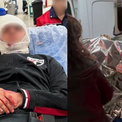 Justiça manda São Paulo FC e Conmebol pagarem pensão a torcedor ferido