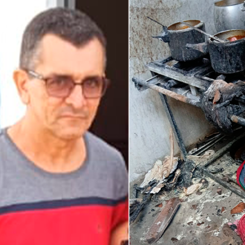 ATUALIZAÇÃO: CHICO VELHO ESTÁ INTERNADO NO IJF APÓS ACIDENTE COM QUEIMADURAS