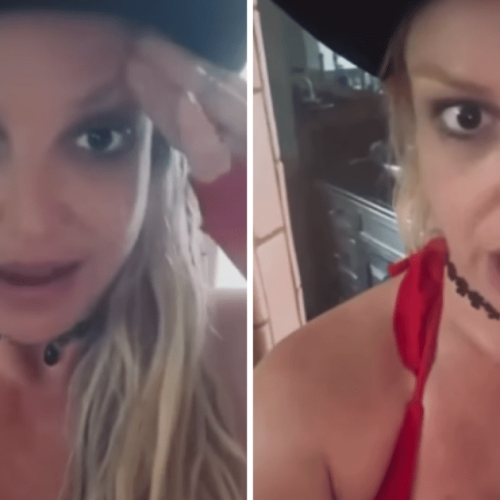 Britney Spears mostra procedimento estético e desabafa: “Ficou muito ruim”